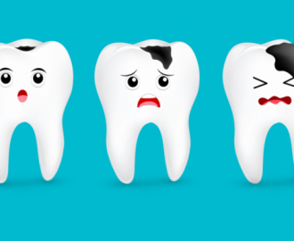 5 cách hạn chế sâu răng hiệu quả từ nha sĩ